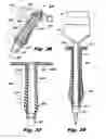 Fig. 15 - Devices for and methods of performing minimally-invasive surgical procedures through a single incision