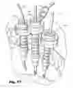 Fig. 29 - Devices for and methods of performing minimally-invasive surgical procedures through a single incision