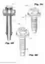 Fig. 30 - Devices for and methods of performing minimally-invasive surgical procedures through a single incision