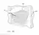 Fig. 09 - APPARATUS AND METHOD FOR TREATING OBSTRUCTIVE SLEEP APNEA