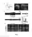 Fig. 08 - Optogenetic magnetic resonance imaging