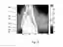 Fig. 16 - ULTRASONIC IMAGE-GUIDED TISSUE-DAMAGING PROCEDURE
