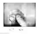 Fig. 17 - ULTRASONIC IMAGE-GUIDED TISSUE-DAMAGING PROCEDURE