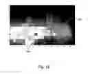Fig. 21 - ULTRASONIC IMAGE-GUIDED TISSUE-DAMAGING PROCEDURE