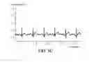 Fig. 08 - Method and system for signal analyzing and processing module