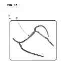 Fig. 19 - Systems, methods, and interfaces for identifying effective electrodes