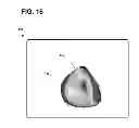 Fig. 20 - Systems, methods, and interfaces for identifying effective electrodes