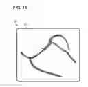 Fig. 19 - Systems, methods, and interfaces for identifying effective electrodes