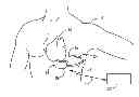 Fig. 01 - Staged rhythm detection system and method