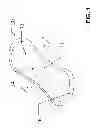 Fig. 02 - SYSTEM AND METHOD FOR IDENTIFYING A CONDITION OF PELVIC FLOOR MUSCLES
