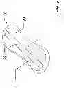 Fig. 07 - SYSTEM AND METHOD FOR IDENTIFYING A CONDITION OF PELVIC FLOOR MUSCLES