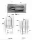 Fig. 41 - Systems, devices, and methods for bodily fluid sample collection