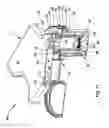 Fig. 25 - Specimen cassette with a removable catch tray for retrieving tissue samples from a fluid stream generated during a medical/surgical procedure