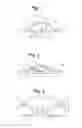 Fig. 02 - Blood glucose management