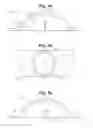 Fig. 03 - Blood glucose management