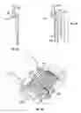 Fig. 45 - Body fluid sampling device with capacitive sensor