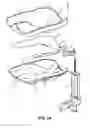 Fig. 02 - DEVICE FOR SUPPORTING AT LEAST A PART OF THE BODY OF A PERSON AND METHOD FOR ADJUSTING SUCH A DEVICE