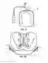 Fig. 04 - DEVICE FOR SUPPORTING AT LEAST A PART OF THE BODY OF A PERSON AND METHOD FOR ADJUSTING SUCH A DEVICE