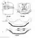 Fig. 08 - DEVICE FOR SUPPORTING AT LEAST A PART OF THE BODY OF A PERSON AND METHOD FOR ADJUSTING SUCH A DEVICE