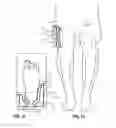 Fig. 10 - DEVICE FOR SUPPORTING AT LEAST A PART OF THE BODY OF A PERSON AND METHOD FOR ADJUSTING SUCH A DEVICE