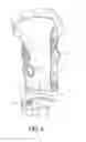Fig. 04 - KNEE BRACE WITH ADJUSTABLE BOLSTER
