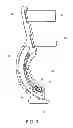 Fig. 04 - Toe orthosis