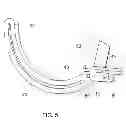 Fig. 06 - Toe orthosis