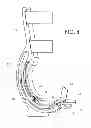 Fig. 07 - Toe orthosis