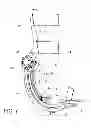 Fig. 08 - Toe orthosis