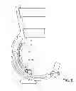 Fig. 09 - Toe orthosis