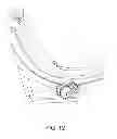 Fig. 13 - Toe orthosis