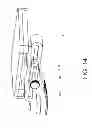 Fig. 15 - Toe orthosis