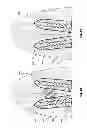 Fig. 09 - Microelectrode and multiple microelectrodes