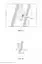Fig. 17 - Devices for delivering substances through an extra-anatomic opening created in an airway