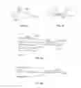 Fig. 19 - Devices for delivering substances through an extra-anatomic opening created in an airway