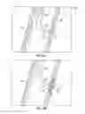 Fig. 20 - Devices for delivering substances through an extra-anatomic opening created in an airway
