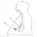 Fig. 01 - SYSTEMS AND METHODS FOR REMOVING INGESTED MATERIAL FROM A STOMACH