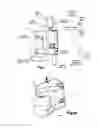 Fig. 04 - SYSTEMS AND METHODS FOR REMOVING INGESTED MATERIAL FROM A STOMACH