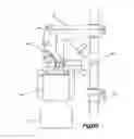 Fig. 07 - SYSTEMS AND METHODS FOR REMOVING INGESTED MATERIAL FROM A STOMACH