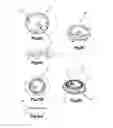 Fig. 11 - SYSTEMS AND METHODS FOR REMOVING INGESTED MATERIAL FROM A STOMACH