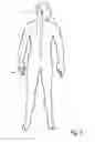 Fig. 06 - Implantable system enabling responsive therapy for pain