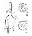 Fig. 02 - MEDICAL DEVICE SYSTEM AND METHOD FOR PUSHABILITY