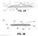 Fig. 03 - Temperature changing intracorporeal fluid delivery system