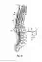 Fig. 03 - Anchor sleeve for implantable lead