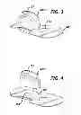 Fig. 05 - WEARABLE INFUSION DEVICE WITH LOW PROFILE HANDLE