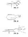 Fig. 13 - WEARABLE INFUSION DEVICE WITH LOW PROFILE HANDLE