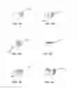 Fig. 05 - Wound dressing of continuous fibers