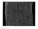 Fig. 01 - Wound dressing for use in vacuum therapy