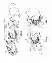 Fig. 06 - Control handles for catheters