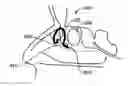 Fig. 01 - DEVICES AND METHODS FOR DELIVERING ACTIVE AGENTS TO THE OSTEOMEATAL COMPLEX